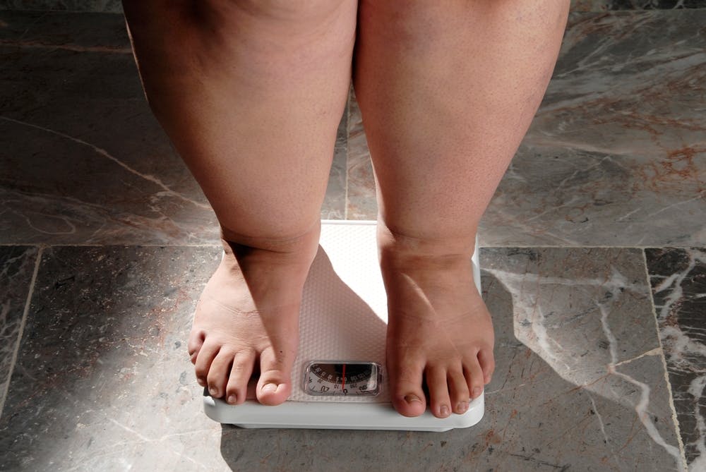Is Obesity an Actual Disease? Here's What the Science Says thumbnail